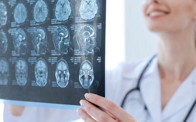 Neurología: comprender el sistema nervioso para cuidar integralmente la salud